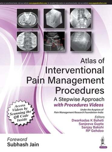 Atlas of Interventional Pain Management Procedures: A Stepwise Approach: New