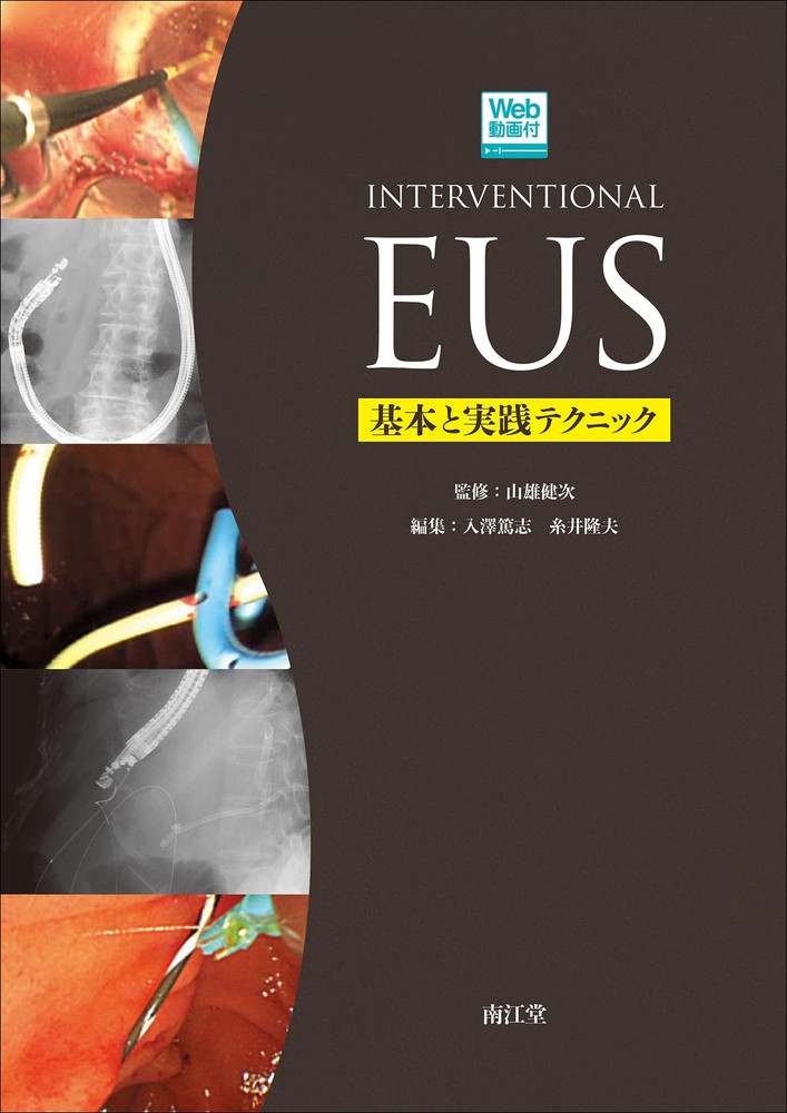 Interventional EUS [with Web Videos]: Basics and Practical Techniques Ken [Book]